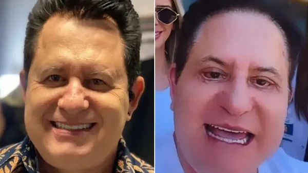 Harmonização Facial de Marrone (Foto: Reprodução Instagram)